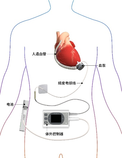 澳洲幸运5
